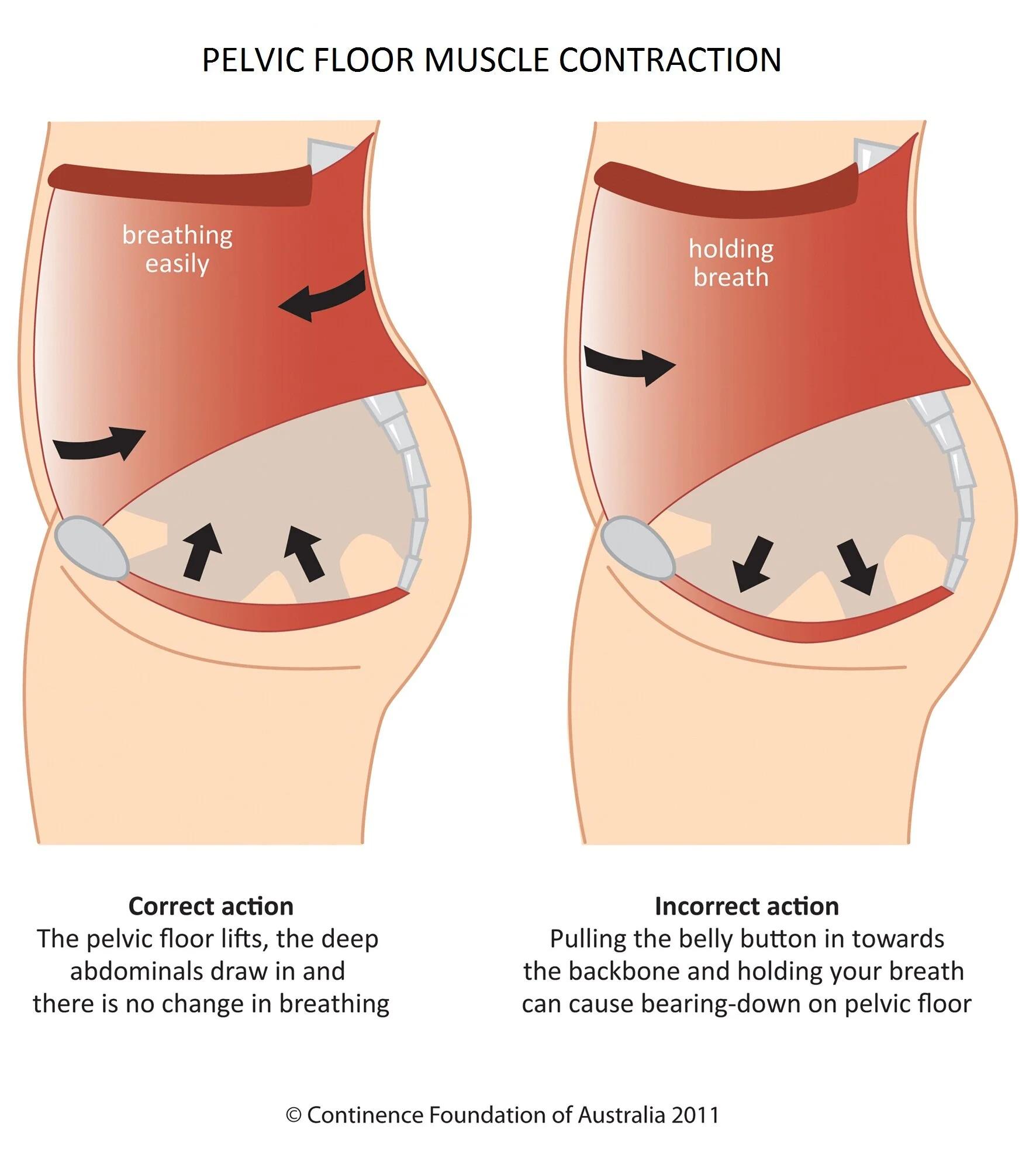 Pelvic floor muscle contraction therapy